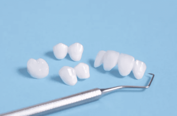 Collection of dental veneers on a blue background with dental scaler Cosmetic dentistry dentist in Destrehan Louisiana  